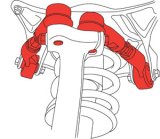 SPC Performance Audi and VW Adjustable Control Arm Kit thumbnail 5