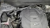 J&L 20-25 Hyundai Palisade / Kia Telluride 3.8L Oil Separator 3.0 Passenger Side - Black Anodize thumbnail 2
